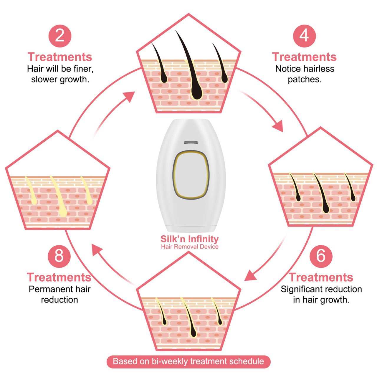 Painless Laser Hair Removal Device