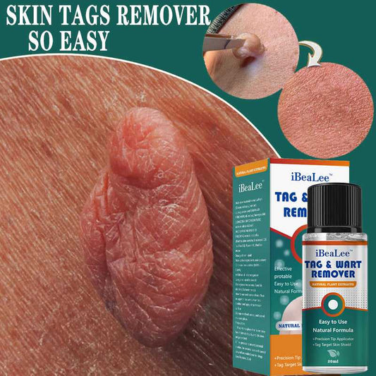 Moisturizing Facial Wart Remover helps eliminate warts while keeping your skin hydrated and soft. Get rid of warts effectively.